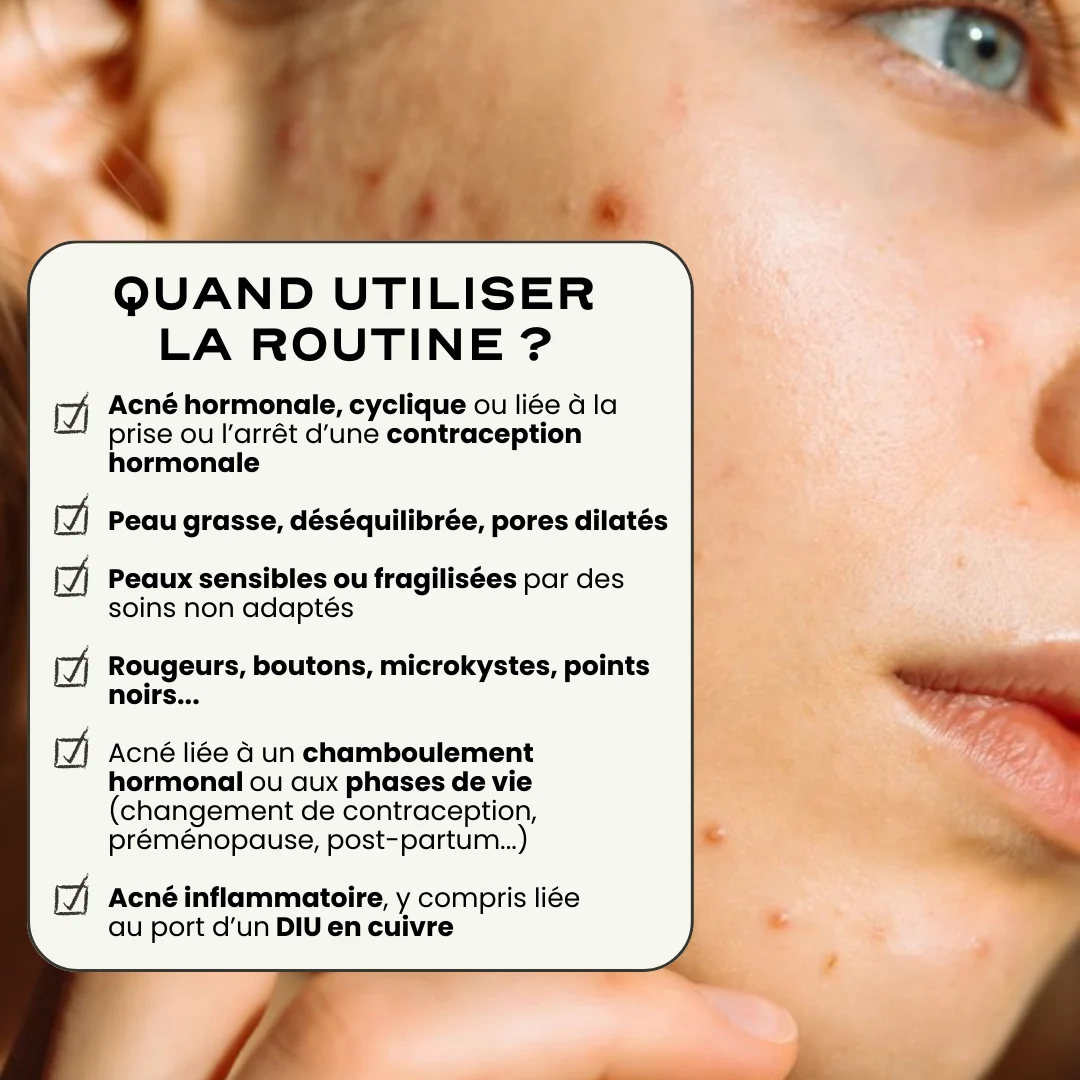 Routine Acné SOS - Image 3